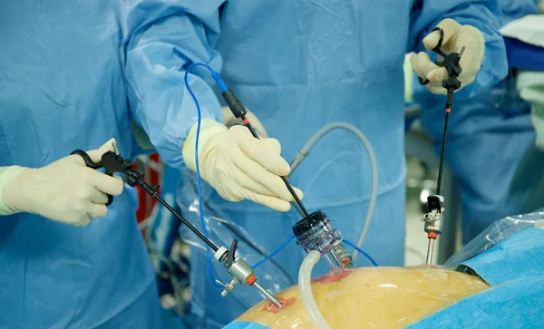 Laparoscopic and Robotic Hernia Repair