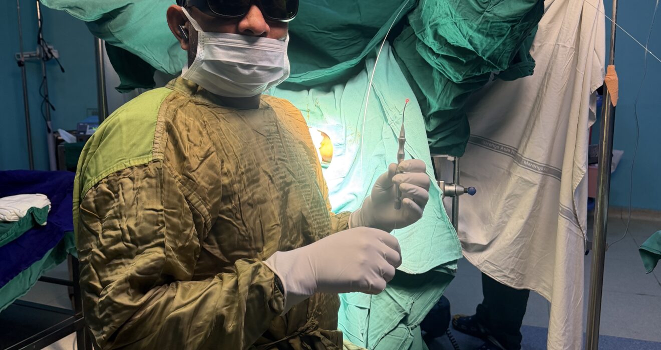 Thrombosed piles can be treated by Laser