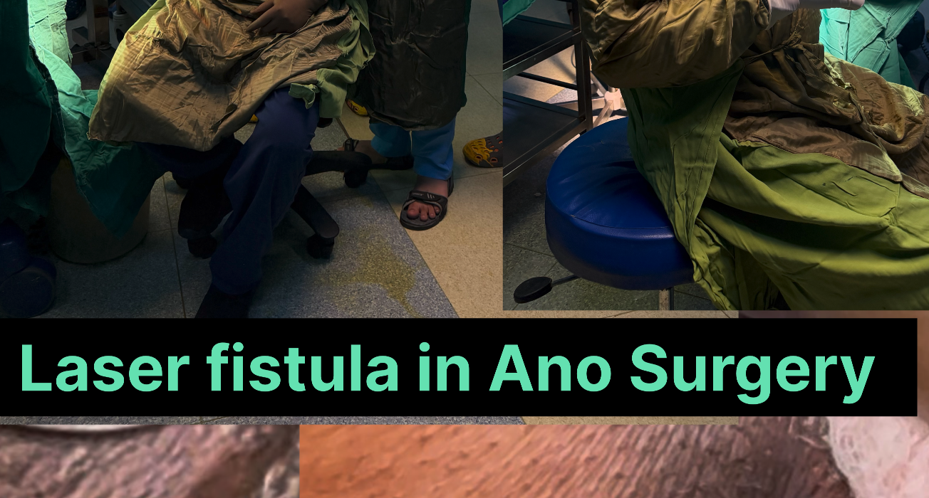 Implementation of laser ablation of fistula tract LAFT Myths vs Facts